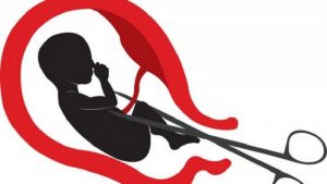 Polres Badung Ungkap Kasus Aborsi, Anak Bawah Umur Gugurkan Kandungan di Kamar Mandi
