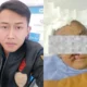 Kondisi Terkini Korban Taufik Hidayat, Mulai Operasi Bibir